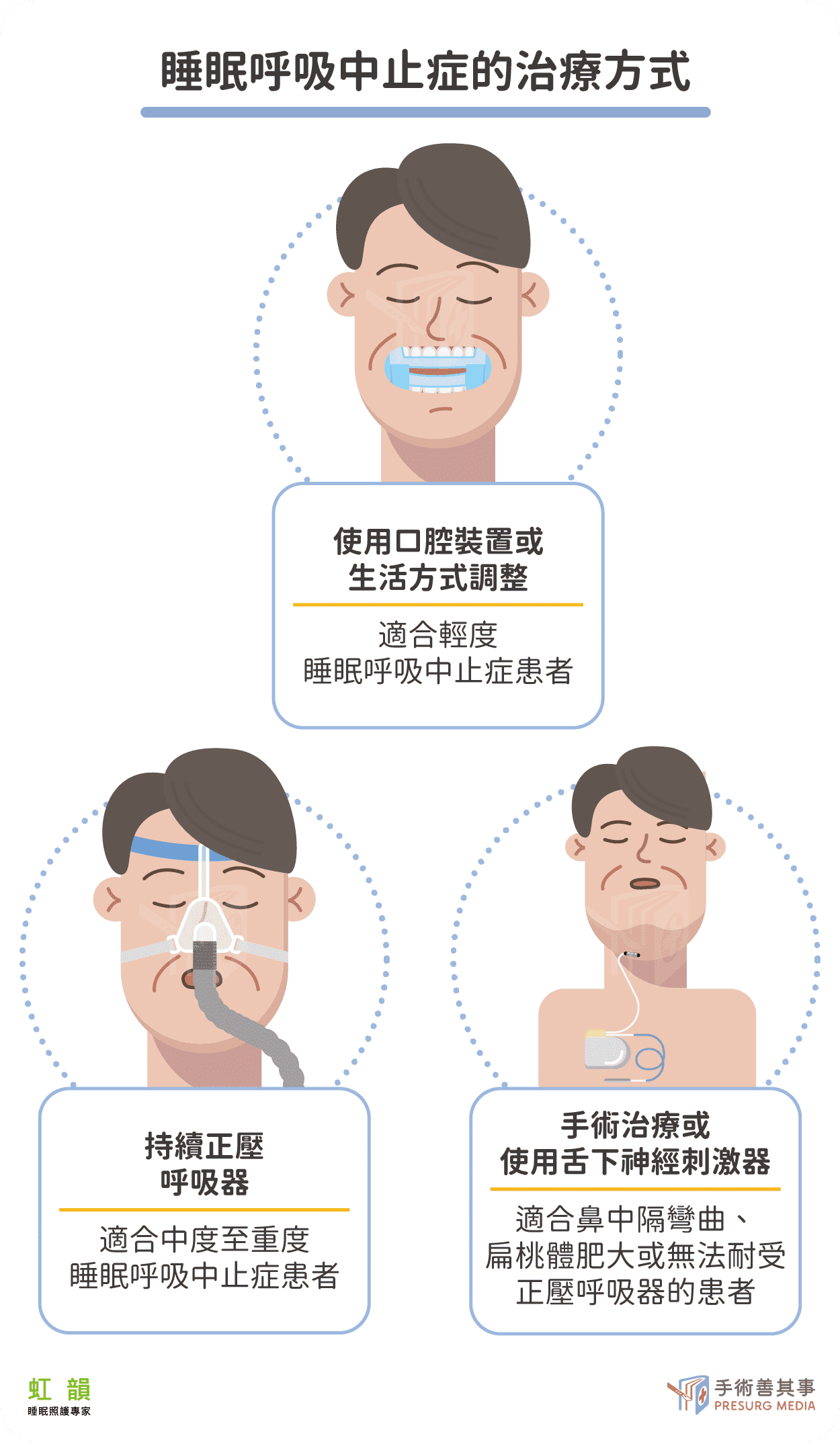 睡眠呼吸中止症處理方式