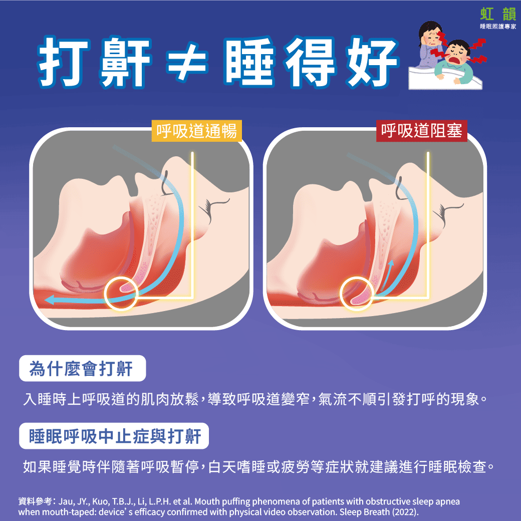 打呼不等於睡得好！